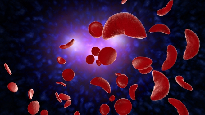 La drépanocytose peut boucher les vaisseaux sanguins (photo d'illustration)