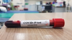 Coronavirus : les tests sérologiques arrivent en Tunisie