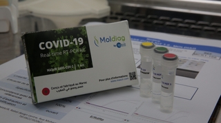 Coronavirus : premier kit de diagnostic du Covid-19 "made in Morocco"