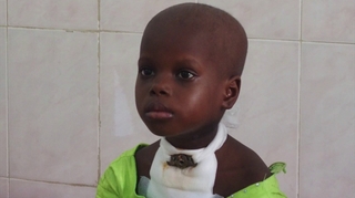 Cameroun : Environ 1000 enfants de moins de 15 ans touchés par le cancer chaque année