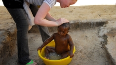 Au Tchad, les albinos réclament leurs droits !