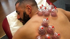 Hijama : pourquoi Karim Benzema est accro à la thérapie des ventouses ?