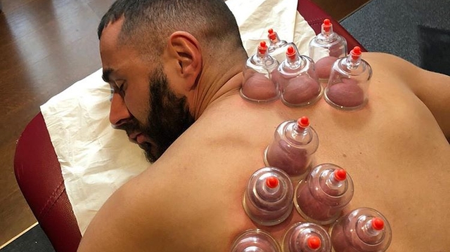 Hijama : pourquoi Karim Benzema est accro à la thérapie des ventouses ?