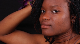Togo : la dermatologie, parent pauvre de la santé !