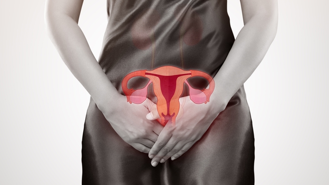 Le cancer du col de l'utérus a tué plus de 310.000 femmes en 2018 dans le monde.