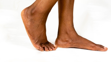 Plaies chroniques du pied