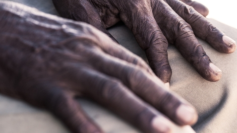 Un bracelet pour sauver les malades d'Alzheimer au Cameroun
