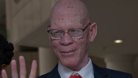 Au Malawi, une personne atteinte d'albinisme devient députée