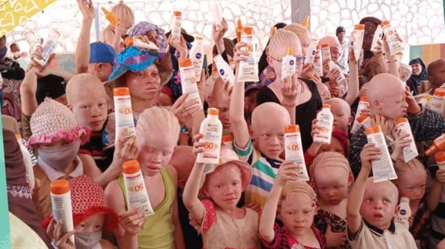 Mali : La championne Nantenin Keita veut protéger les albinos du soleil