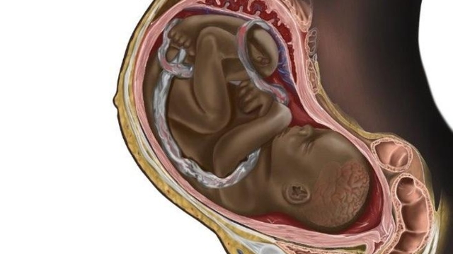 Un étudiant en médecine casse Internet en illustrant un foetus à la peau noire 