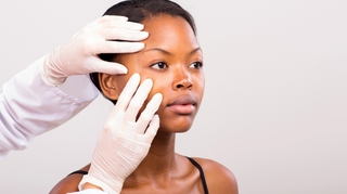 Cancer de la peau en Afrique : pourquoi le diagnostic est difficile à poser
