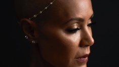 Alopécie : pourquoi la blague sur les cheveux de Jada Smith ne passe pas