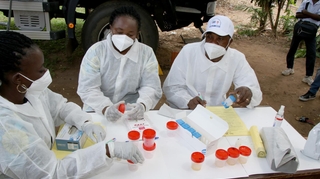 La RD Congo, deuxième pays africain le plus touché par la tuberculose