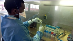 Vers un test urinaire pour mieux détecter la tuberculose chez les personnes vivant avec le VIH ?
