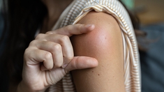Douleur au bras, boule... pourquoi ces effets indésirables ne doivent pas vous éloigner des vaccins
