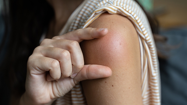 Douleur au bras, boule... pourquoi ces effets indésirables ne doivent pas vous éloigner des vaccins