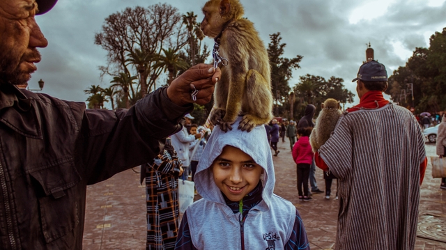 Toujours pas de variole du singe au Maroc, les trois cas suspects sont négatifs