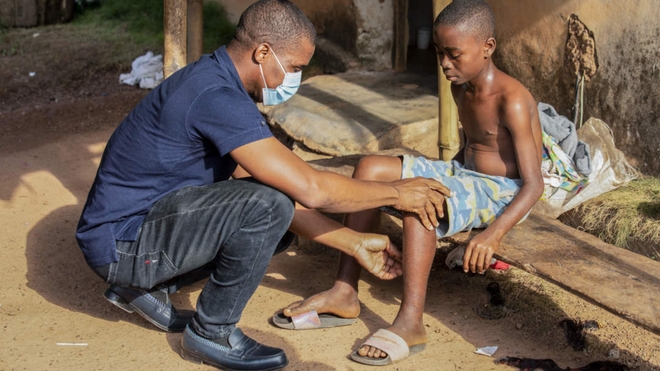 Élysée, ancien malade de la lèpre, dépisté à temps et guéri en Côte d’Ivoire