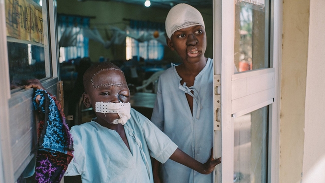 Umar, un patient de 8 ans et Adamu,15 ans, se tiennent à l'entrée du service post-opératoire de l'hôpital Sokoto Noma, au Nigéria
