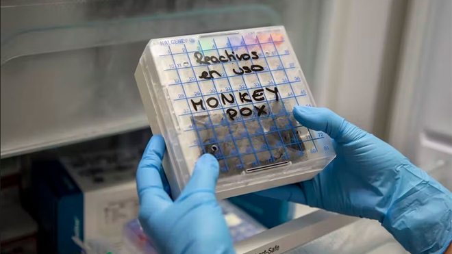 Un technicien de laboratoire en Espagne prélève un réactif pour tester des échantillons suspects de variole du singe
