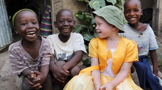Au Congo-Brazzaville, des diplomates au chevet des albinos