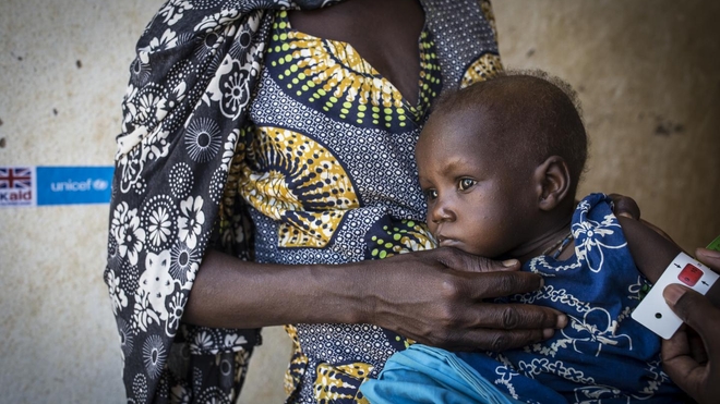  Près de la moitié des décès d'enfants de moins de 5 ans au Mali sont liés à la malnutrition