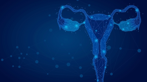 Connaissez-vous le syndrome des ovaires polykystiques ?