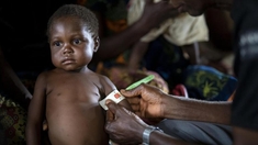 En RD Congo, la malnutrition affecte la santé mentale de près de 80% des enfants de 0 à 5 ans