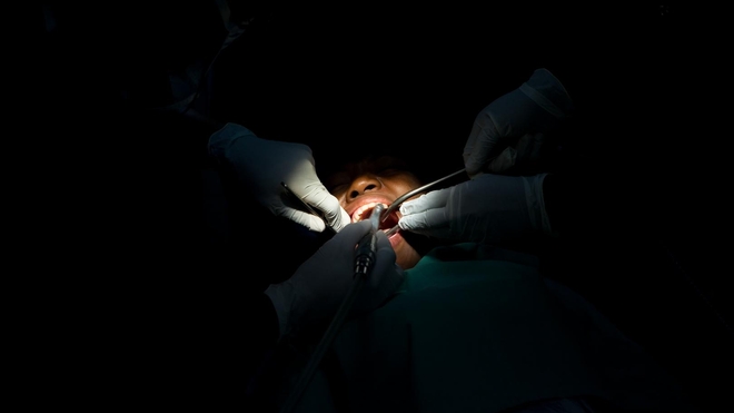 La carie dentaire non traitée est la plus fréquente des maladies de la bouche