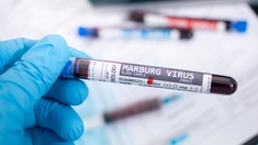 Le virus de Marburg fait 20 morts en Guinée équatoriale