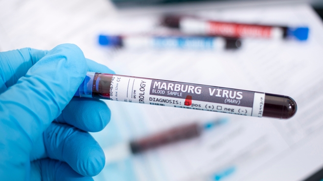 Le virus de Marburg continue de s'étendre en Afrique