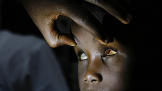 Rougeole, paludisme, méningite... ces maladies infectieuses qui peuvent vous voler la vue
