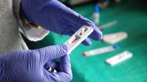 VIH : en Guinée, Médecins sans frontières inaugure un point de distribution des antirétroviraux