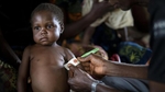 Malnutrition chronique : démarrage poussif de la lutte au Bénin