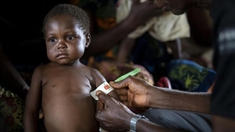 Malnutrition chronique : démarrage poussif de la lutte au Bénin
