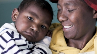A Madagascar, une ONG rend le sourire aux enfants atteints de becs de lièvre