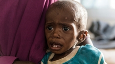 Madagascar : la malnutrition des enfants pourrait quadrupler