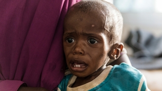 Madagascar : la malnutrition des enfants pourrait quadrupler