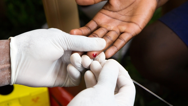 L'Afrique du Sud accélère dans la riposte contre le VIH/ Sida