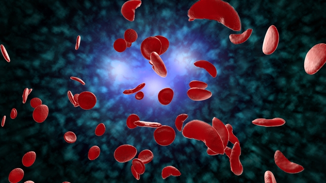 Illustration 3D des cellules sanguines de la drépanocytose (photo d'illustration)