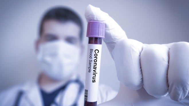 Le ministère de la Santé assure que les tests sérologiques sont "conformes aux meilleurs standards internationaux" (photo d'illustration)